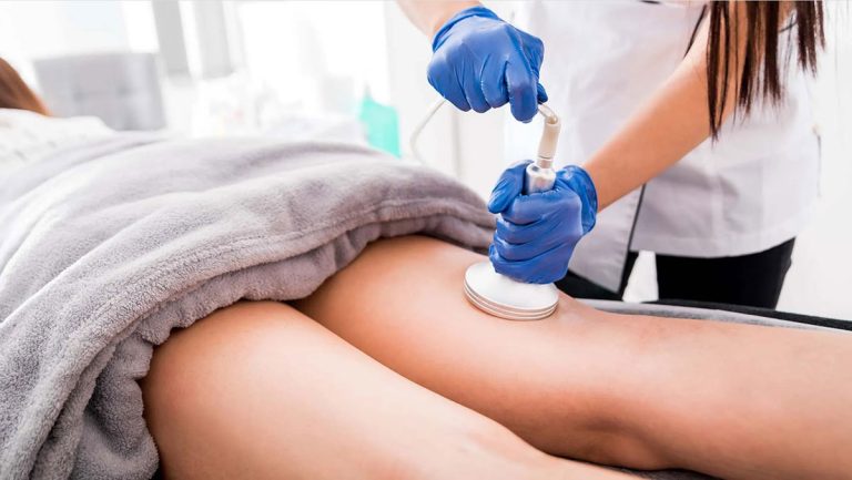 Venus Legacy for cellulite